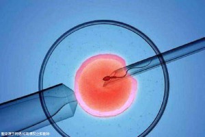 供卵代怀包生男孩机构